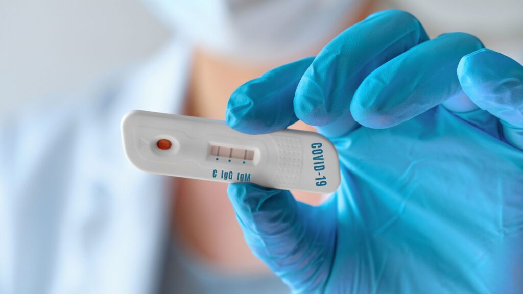 operadoras de saúde teste rápido Covid-19